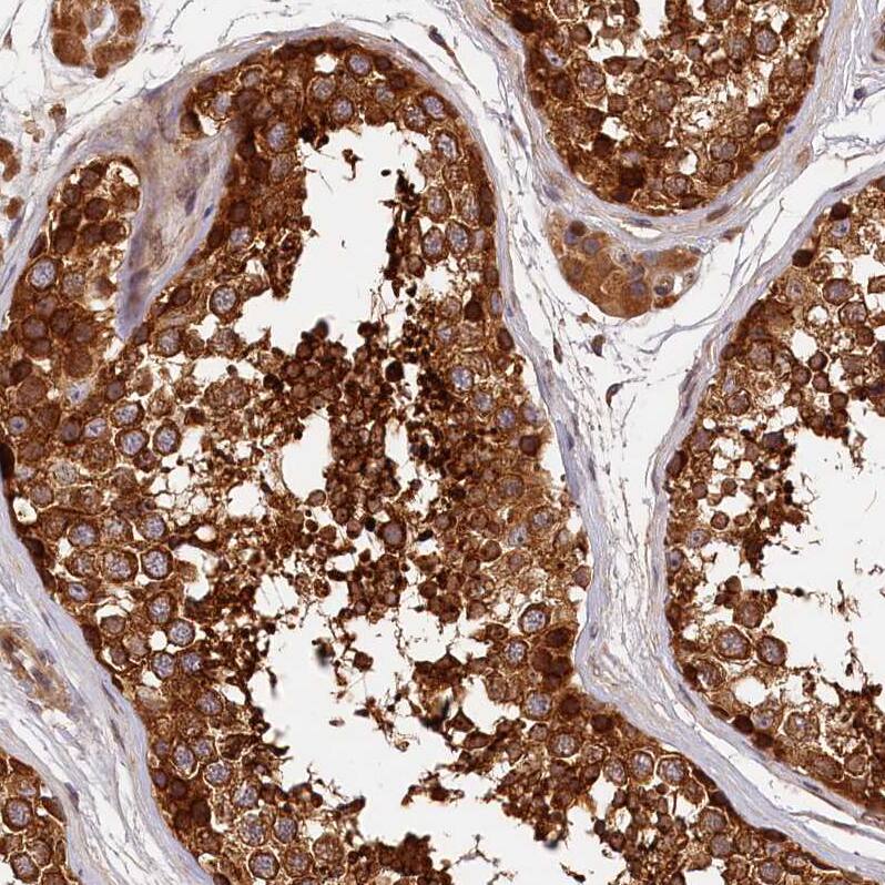 HO-2/HMOX2 Antibody - BSA Free Immunohistochemistry: HO-2/HMOX2 Antibody - BSA Free [NBP1-91981]