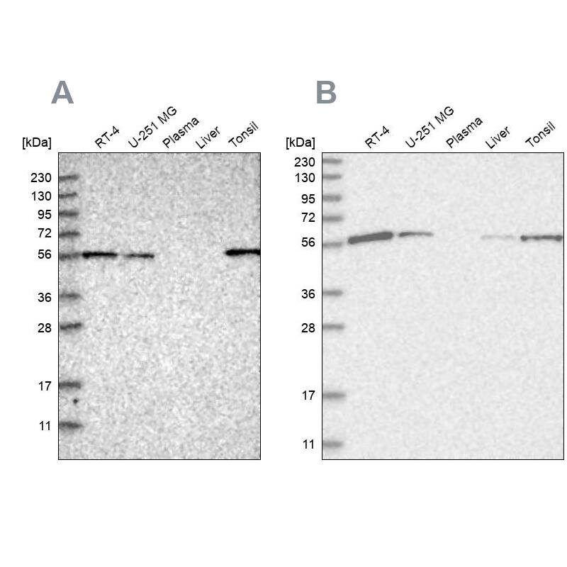 HIP-55 Antibody - BSA Free Western Blot: HIP-55 Antibody - BSA Free [NBP1-91988]