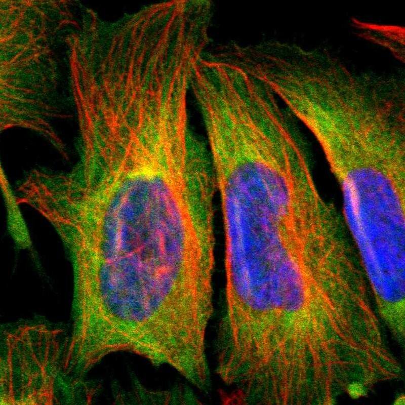 HKR2 Antibody - BSA Free Immunocytochemistry/ Immunofluorescence: HKR2 Antibody [NBP1-91992]