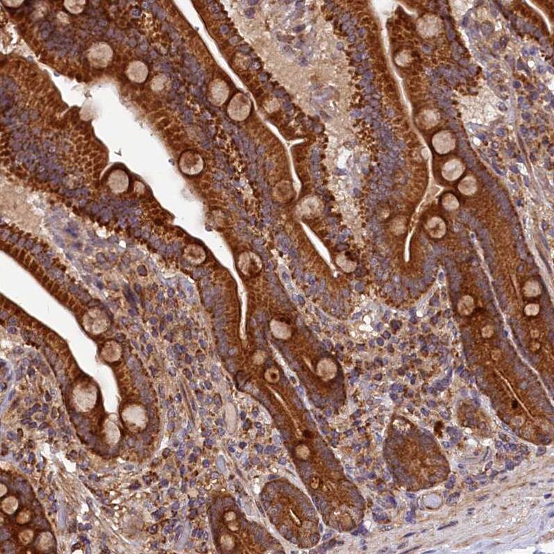 HLRC1 Antibody - BSA Free Immunohistochemistry: HLRC1 Antibody - BSA Free [NBP1-91994]