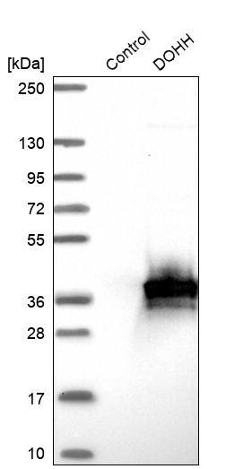 HLRC1 Antibody - BSA Free Western Blot: HLRC1 Antibody - BSA Free [NBP1-91994]