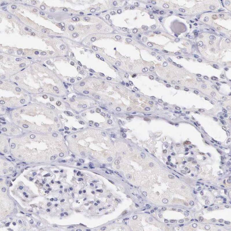 HMG2L1 Antibody - BSA Free Immunohistochemistry: HMG2L1 Antibody - BSA Free [NBP1-91995]