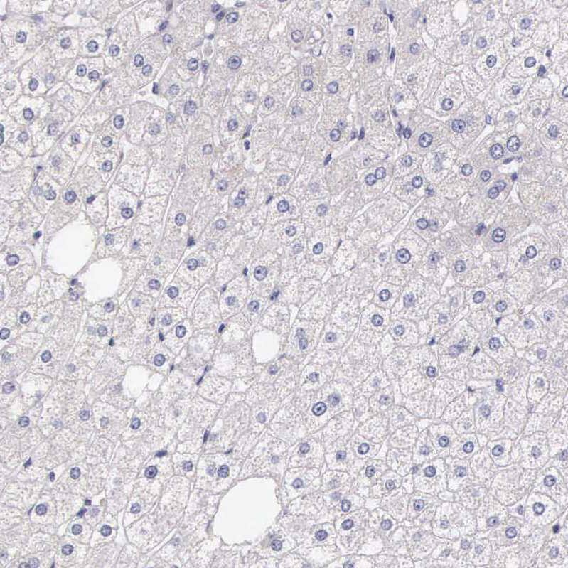 HMG2L1 Antibody - BSA Free Immunohistochemistry: HMG2L1 Antibody - BSA Free [NBP1-91995]