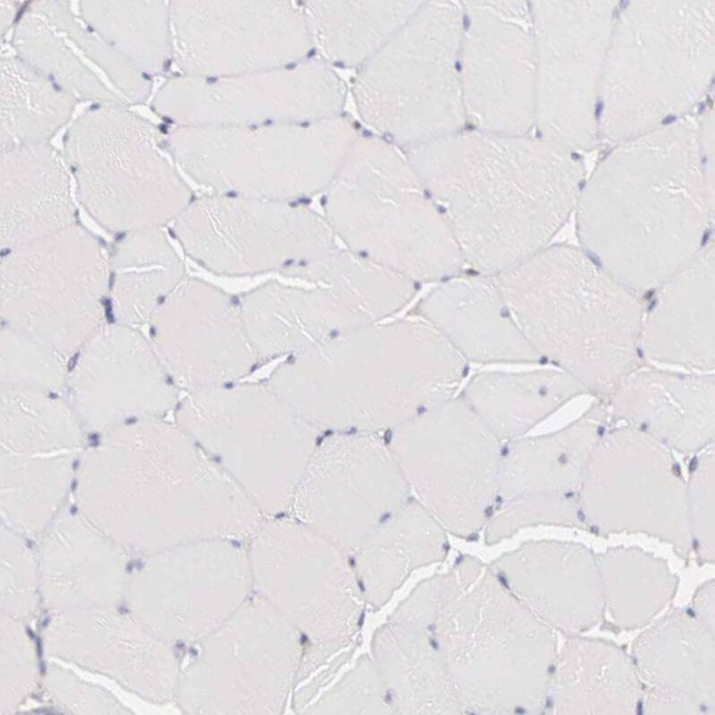 HMG2L1 Antibody - BSA Free Immunohistochemistry: HMG2L1 Antibody - BSA Free [NBP1-91995]