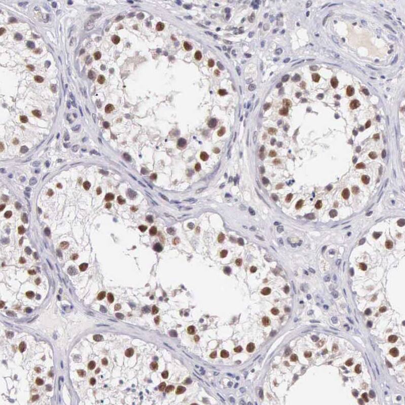 HMG2L1 Antibody - BSA Free Immunohistochemistry: HMG2L1 Antibody - BSA Free [NBP1-91995]