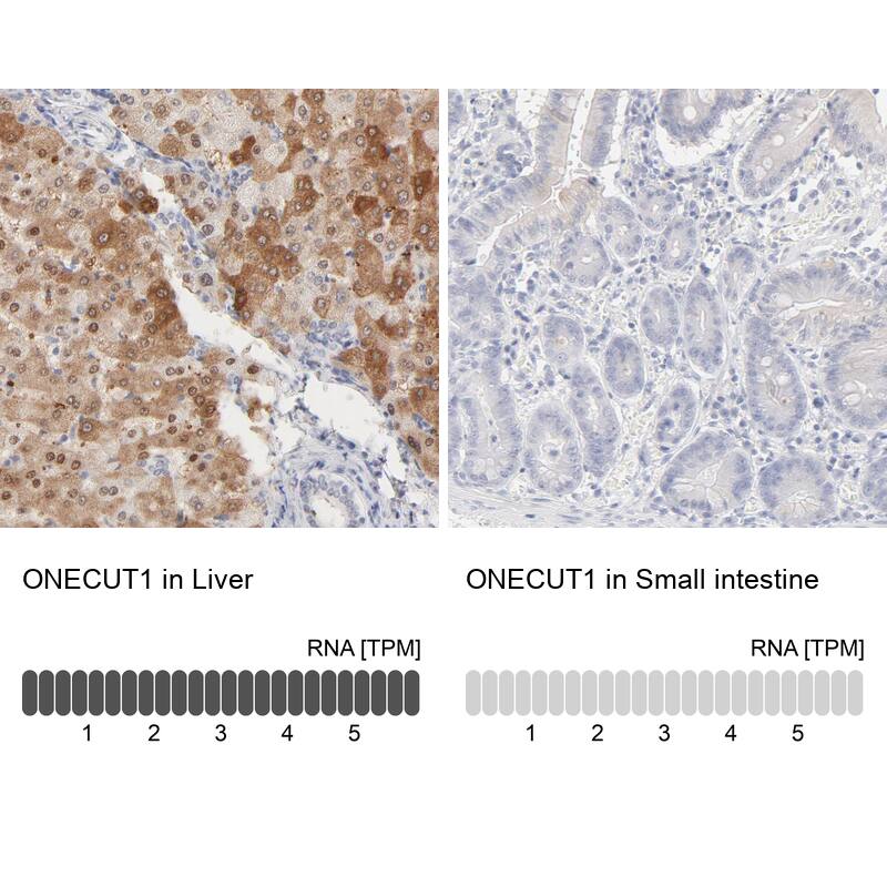 HNF-6/ONECUT1 Antibody - BSA Free Immunohistochemistry: HNF-6/ONECUT1 Antibody - BSA Free [NBP1-91998]