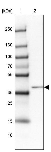 HNF-6/ONECUT1 Antibody - BSA Free Western Blot: HNF-6/ONECUT1 Antibody - BSA Free [NBP1-91998]