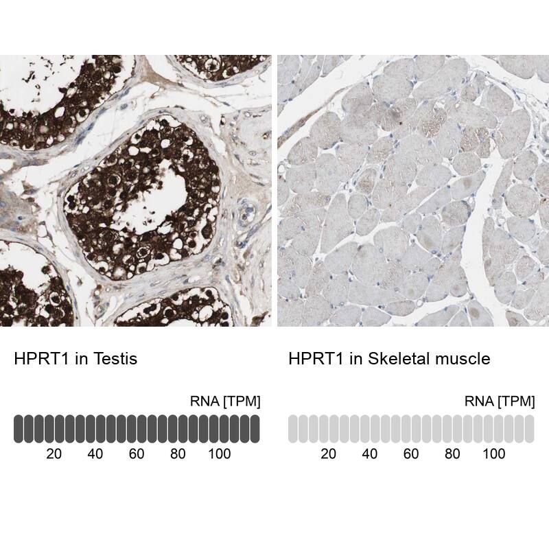HPRT Antibody - BSA Free Immunohistochemistry: HPRT Antibody - BSA Free [NBP1-92006]