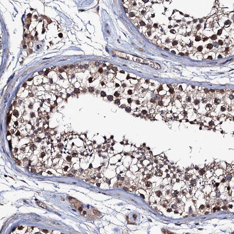 HPSC152 Antibody - BSA Free Immunohistochemistry: HPSC152 Antibody - BSA Free [NBP1-92008]