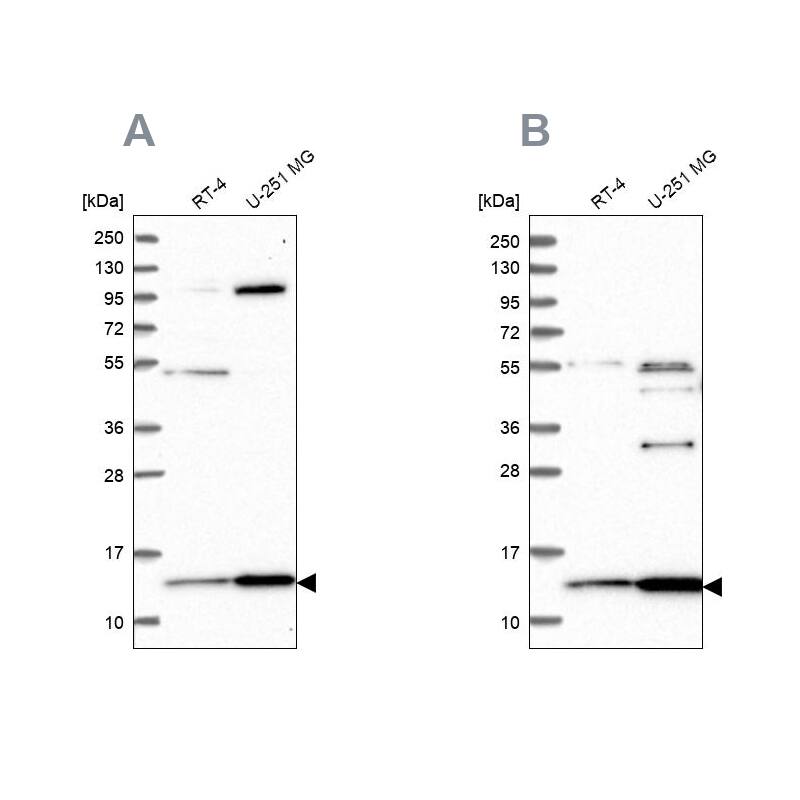 HPSC152 Antibody - BSA Free Western Blot: HPSC152 Antibody - BSA Free [NBP1-92008]