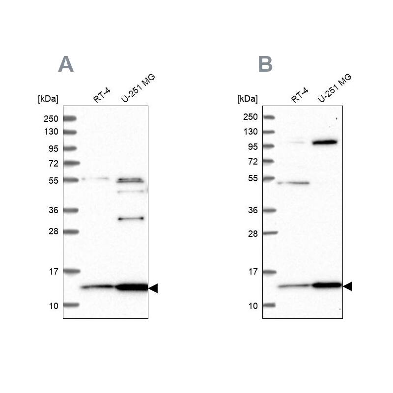 HPSC152 Antibody - BSA Free Western Blot: HPSC152 Antibody - BSA Free [NBP1-92009]