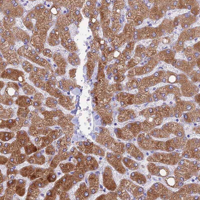 HSD17B2 Antibody - BSA Free Immunohistochemistry: HSD17B2 Antibody - BSA Free [NBP1-92011]