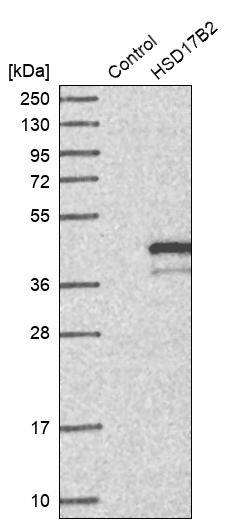 HSD17B2 Antibody - BSA Free Western Blot: HSD17B2 Antibody - BSA Free [NBP1-92011]