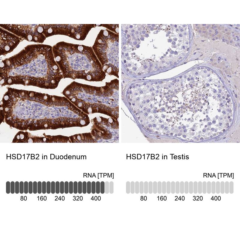 HSD17B2 Antibody - BSA Free Immunohistochemistry: HSD17B2 Antibody - BSA Free [NBP1-92011]