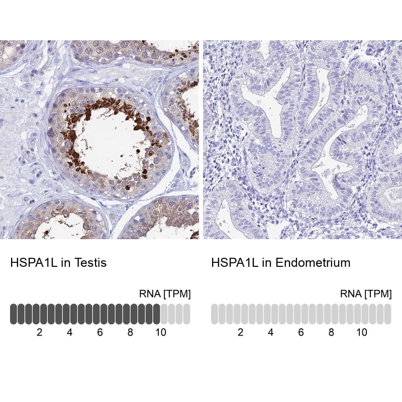 HspA1L Antibody - BSA Free Immunohistochemistry: HspA1L Antibody - BSA Free [NBP1-92012]