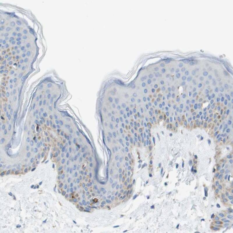 HSPC105 Antibody - BSA Free Immunohistochemistry: HSPC105 Antibody - BSA Free [NBP1-92015]