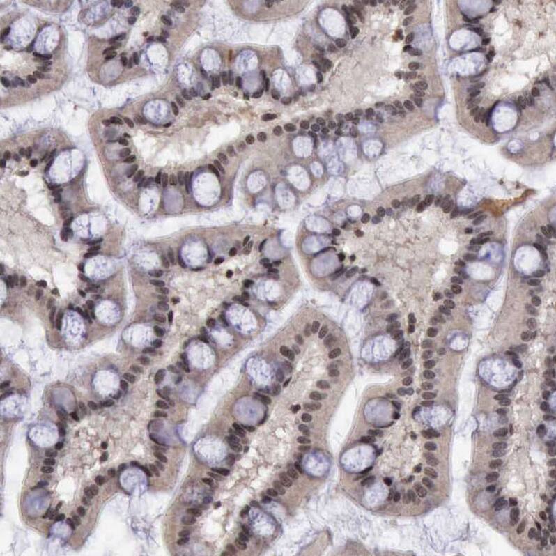 HTF9C Antibody - BSA Free Immunohistochemistry: HTF9C Antibody - BSA Free [NBP1-92016]