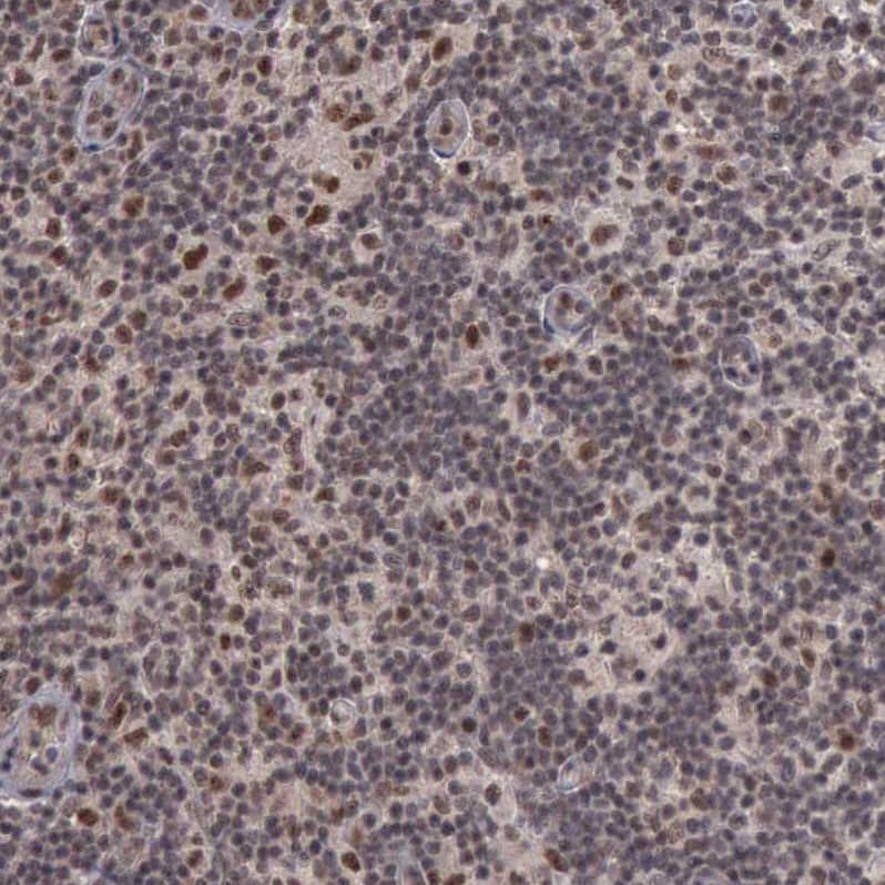 HTF9C Antibody - BSA Free Immunohistochemistry: HTF9C Antibody - BSA Free [NBP1-92016]