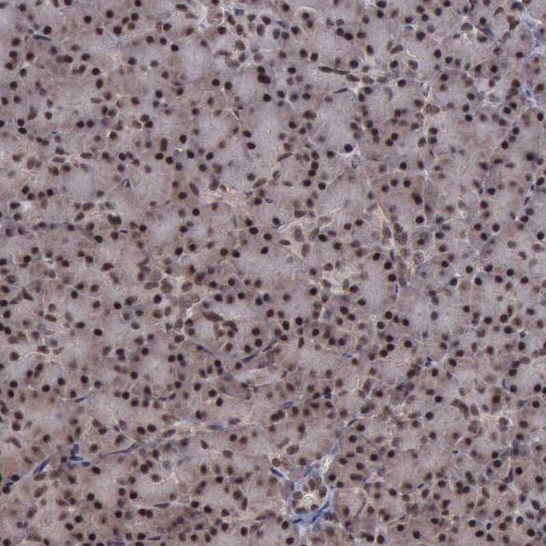 HTF9C Antibody - BSA Free Immunohistochemistry: HTF9C Antibody - BSA Free [NBP1-92016]