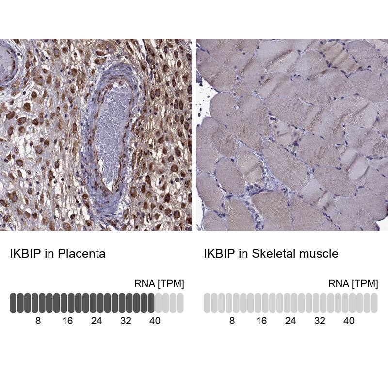 IKIP Antibody - BSA Free Immunohistochemistry: IKIP Antibody - BSA Free [NBP1-92022]