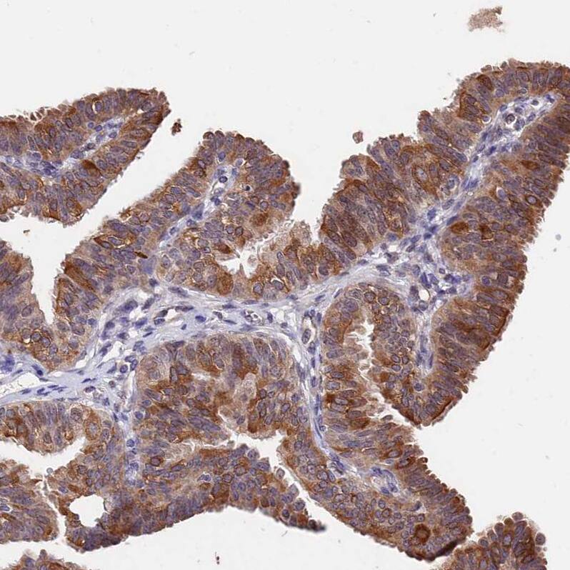 INPP4A Antibody - BSA Free Immunohistochemistry: INPP4A Antibody - BSA Free [NBP1-92023]