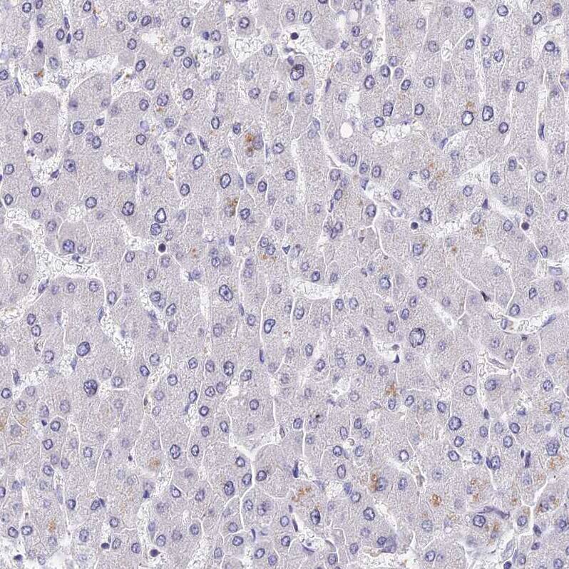 INPP4A Antibody - BSA Free Immunohistochemistry: INPP4A Antibody - BSA Free [NBP1-92023]