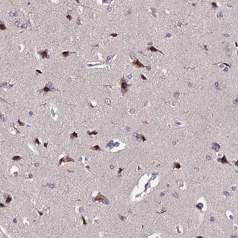 INPP4A Antibody - BSA Free Immunohistochemistry: INPP4A Antibody - BSA Free [NBP1-92023]