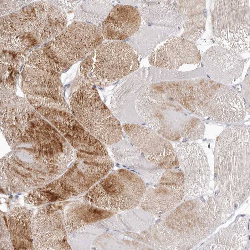 Invadolysin Antibody - BSA Free Immunohistochemistry: Invadolysin Antibody - BSA Free [NBP1-92025]