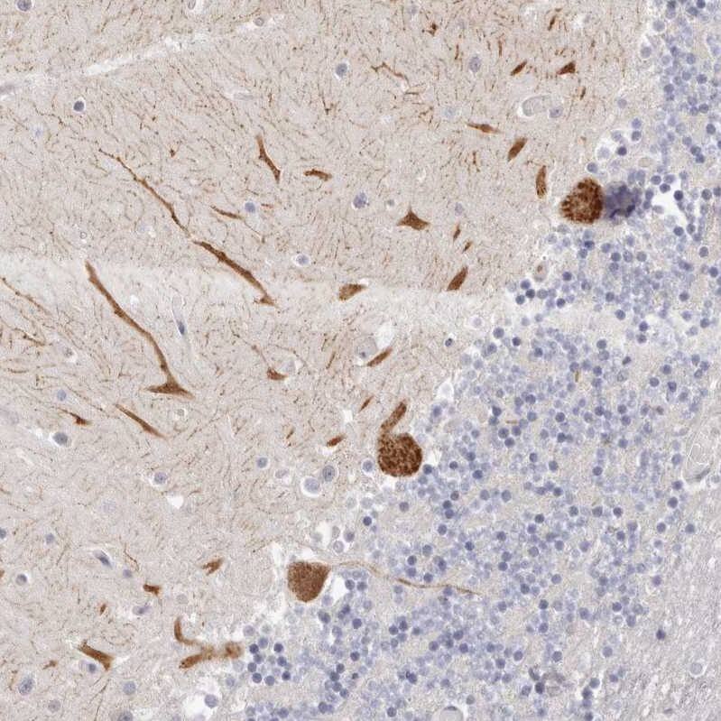 Invadolysin Antibody - BSA Free Immunohistochemistry: Invadolysin Antibody - BSA Free [NBP1-92025]