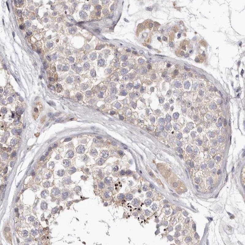 Invadolysin Antibody - BSA Free Immunohistochemistry: Invadolysin Antibody - BSA Free [NBP1-92025]
