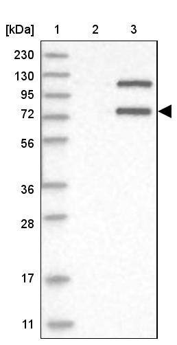 Invadolysin Antibody - BSA Free Western Blot: Invadolysin Antibody - BSA Free [NBP1-92025]