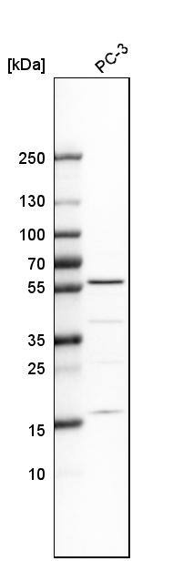 IP6K1 Antibody - BSA Free Western Blot: IP6K1 Antibody - BSA Free [NBP1-92026]
