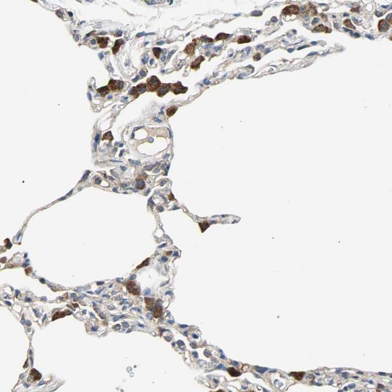 IRF3 Antibody - BSA Free Immunohistochemistry: IRF3 Antibody - BSA Free [NBP1-92028]