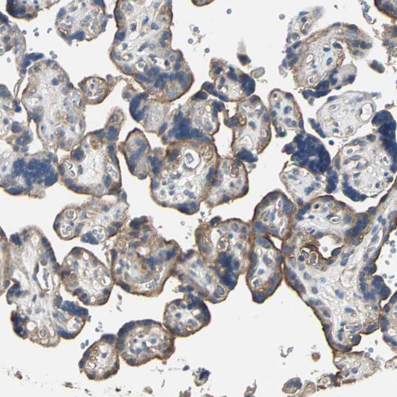 IRF3 Antibody - BSA Free Immunohistochemistry: IRF3 Antibody - BSA Free [NBP1-92028]