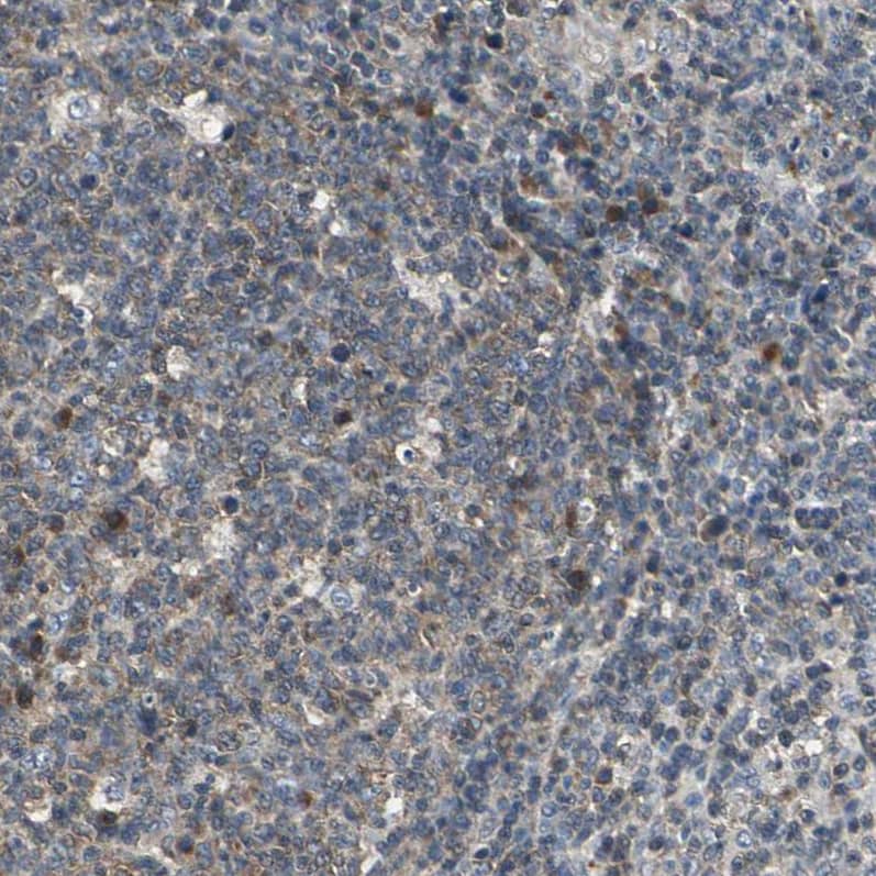 IRF3 Antibody - BSA Free Immunohistochemistry: IRF3 Antibody - BSA Free [NBP1-92028]