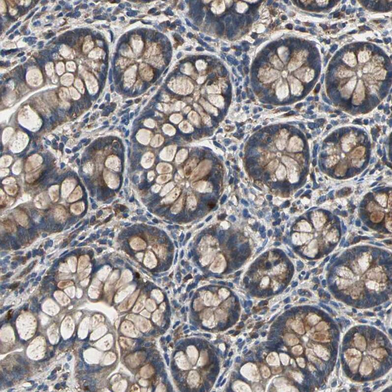 IRF3 Antibody - BSA Free Immunohistochemistry: IRF3 Antibody - BSA Free [NBP1-92028]