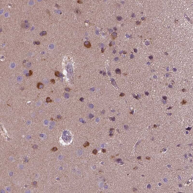Kazrin Antibody - BSA Free (NBP1-92038) by Novus, Part of Bio-Techne