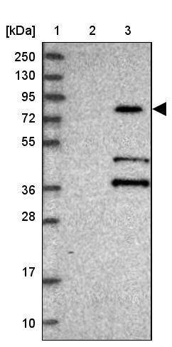 KBTBD7 Antibody - BSA Free Western Blot: KBTBD7 Antibody - BSA Free [NBP1-92040]