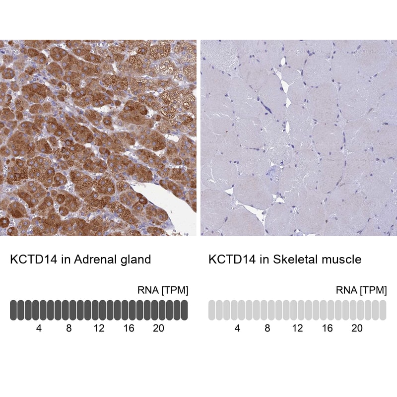 KCTD14 Antibody - BSA Free Immunohistochemistry: KCTD14 Antibody - BSA Free [NBP1-92042]