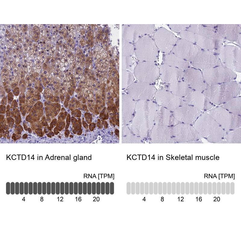 KCTD14 Antibody - BSA Free Immunohistochemistry: KCTD14 Antibody - BSA Free [NBP1-92043]