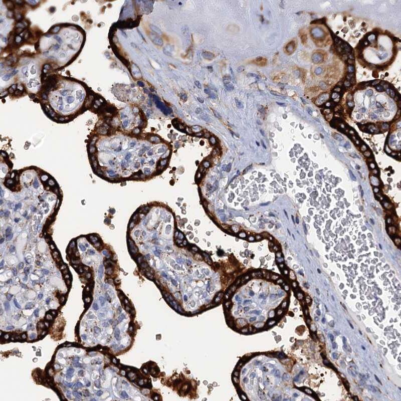 KDELC2 Antibody - BSA Free Immunohistochemistry-Paraffin: KDELC2 Antibody [NBP1-92047]
