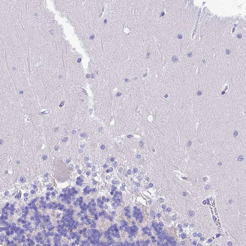 KDELR3 Antibody - BSA Free Immunohistochemistry: KDELR3 Antibody - BSA Free [NBP1-92048]