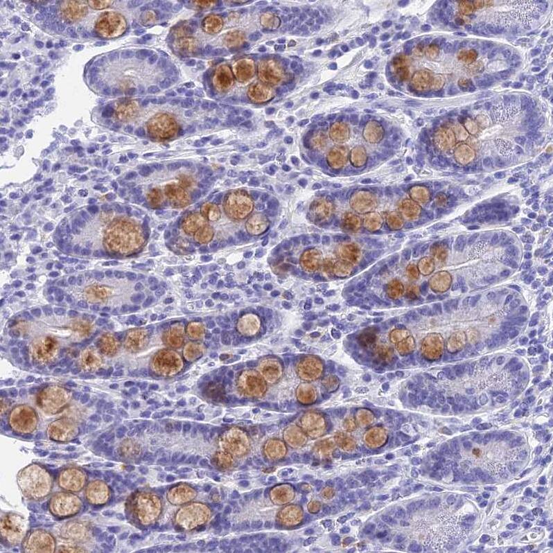 KDELR3 Antibody - BSA Free Immunohistochemistry: KDELR3 Antibody - BSA Free [NBP1-92048]