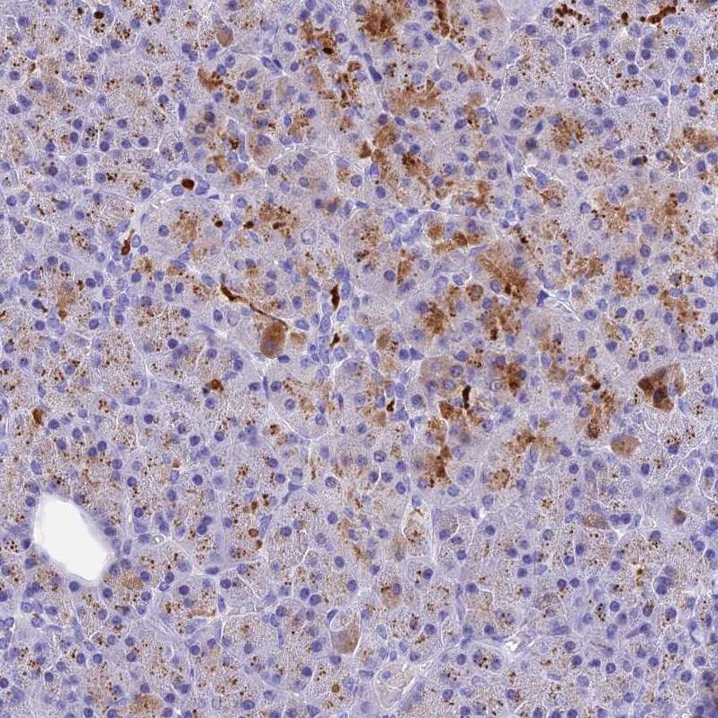 KDELR3 Antibody - BSA Free Immunohistochemistry: KDELR3 Antibody - BSA Free [NBP1-92048]