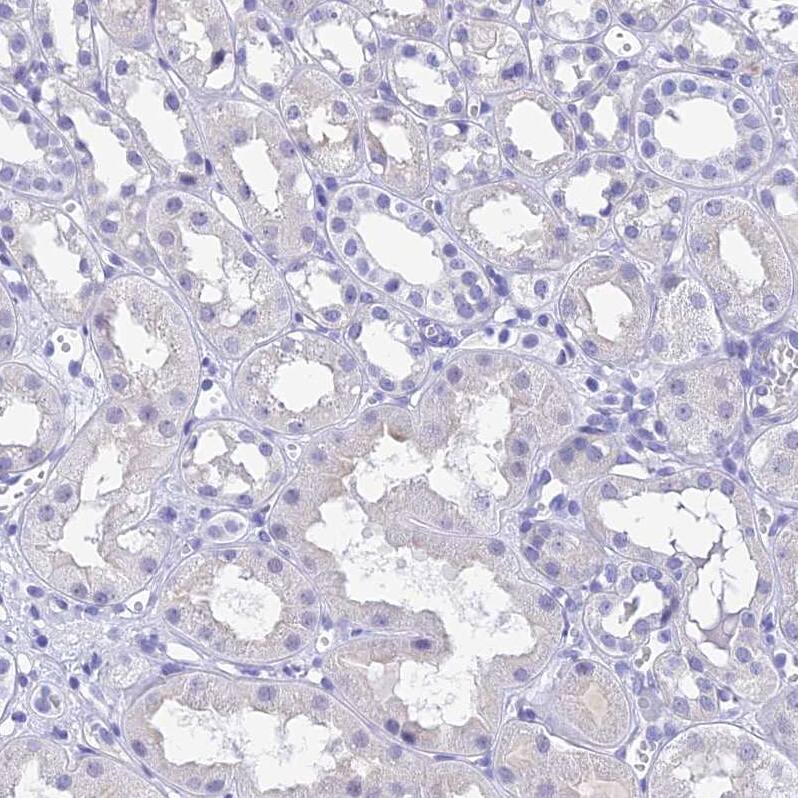 KDELR3 Antibody - BSA Free Immunohistochemistry: KDELR3 Antibody - BSA Free [NBP1-92048]