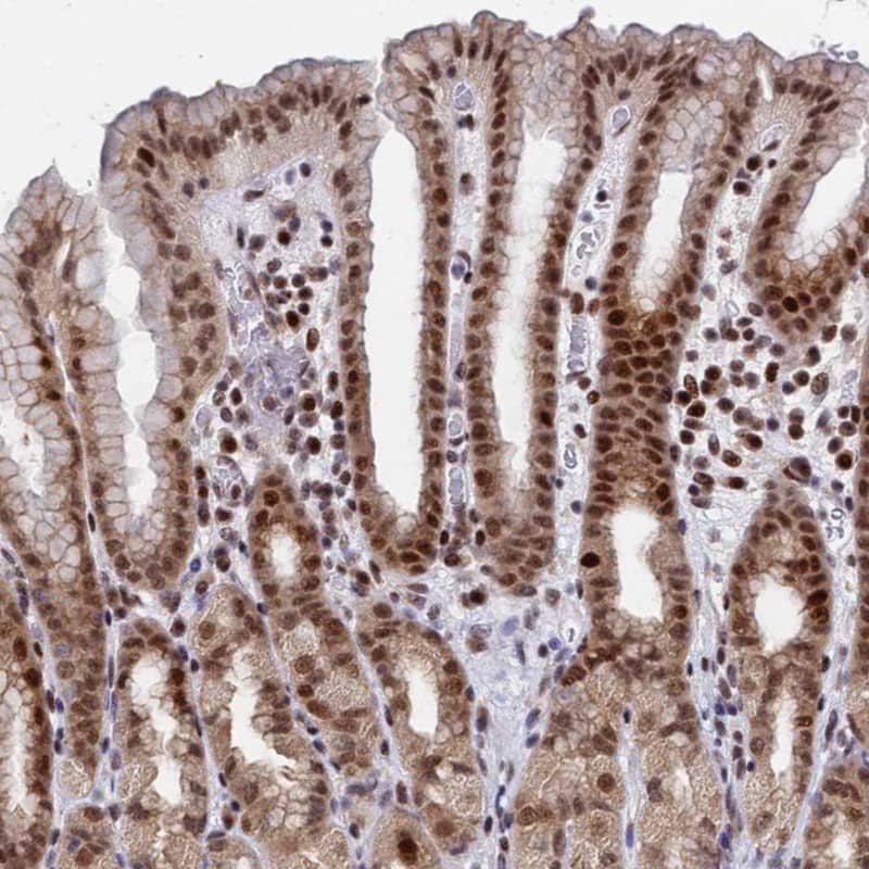 AP5Z1 Antibody - BSA Free Immunohistochemistry: AP5Z1 Antibody - BSA Free [NBP1-92049]