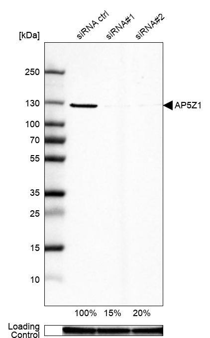 AP5Z1 Antibody - BSA Free Western Blot: AP5Z1 Antibody - BSA Free [NBP1-92049]