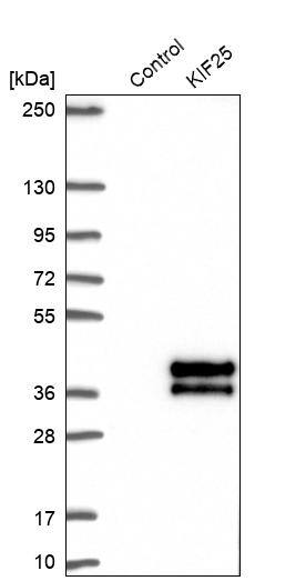 KIF25 Antibody - BSA Free Western Blot: KIF25 Antibody - BSA Free [NBP1-92055]