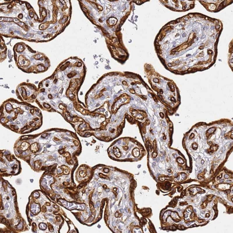 KIF7 Antibody - BSA Free Immunohistochemistry: KIF7 Antibody - BSA Free [NBP1-92056]