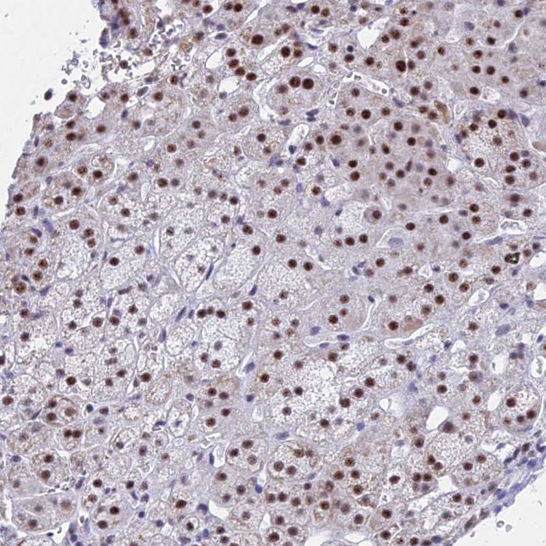KLF14 Antibody - BSA Free Immunohistochemistry: KLF14 Antibody - BSA Free [NBP1-92058]